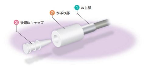 セラミックスコーン